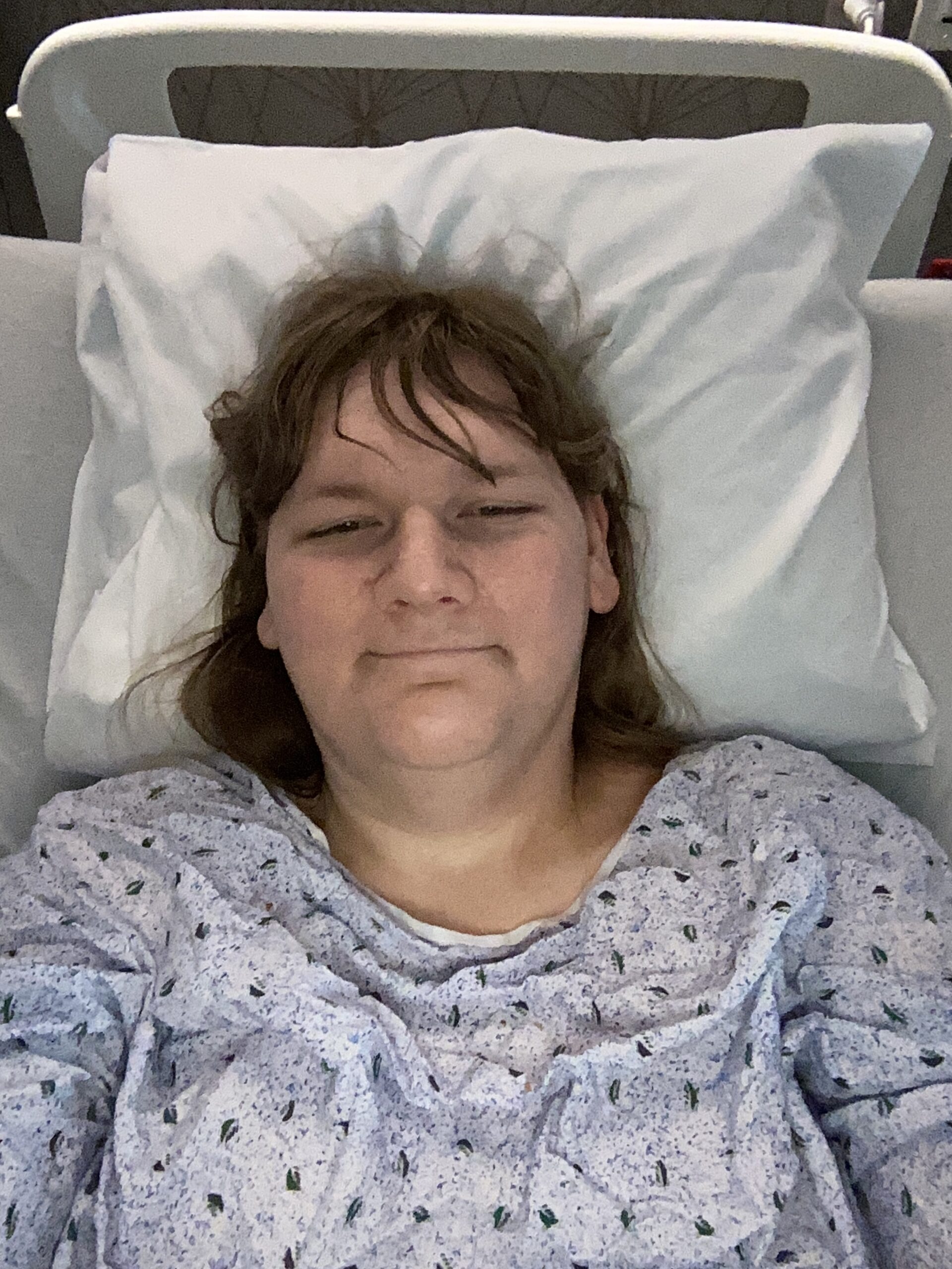 Surgery update